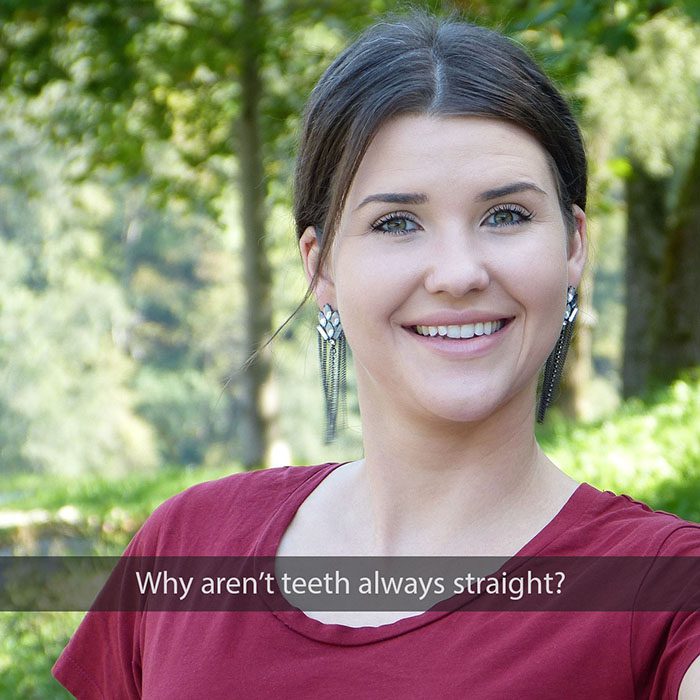 why crooked teeth 2022 700 Scripps Poway Orthodontics